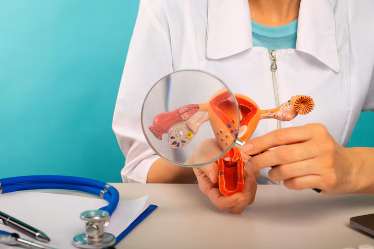 Ovarian Cystectomy