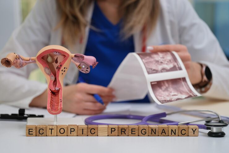 Management of Ectopic Pregnancy