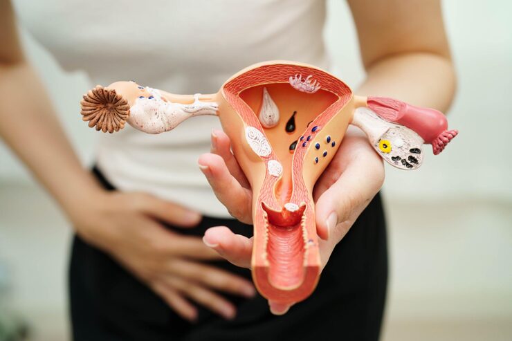 Fibroids of Cervix