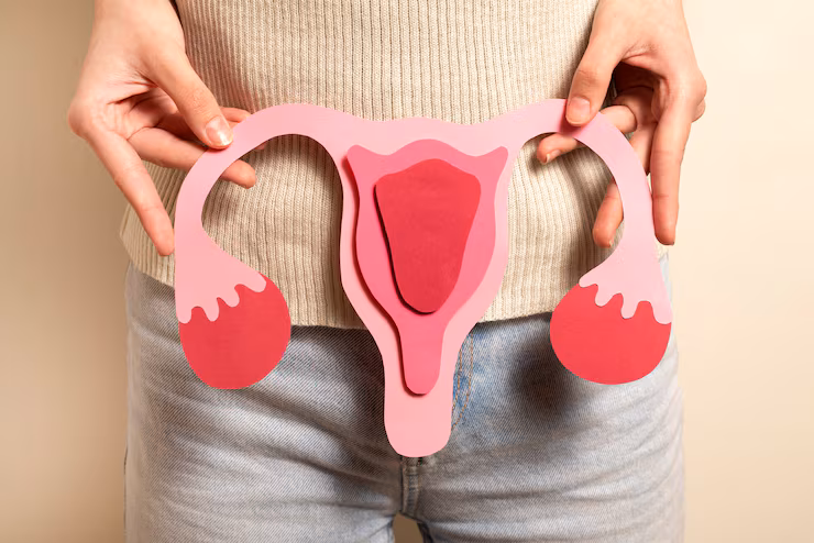 Hysterectomy