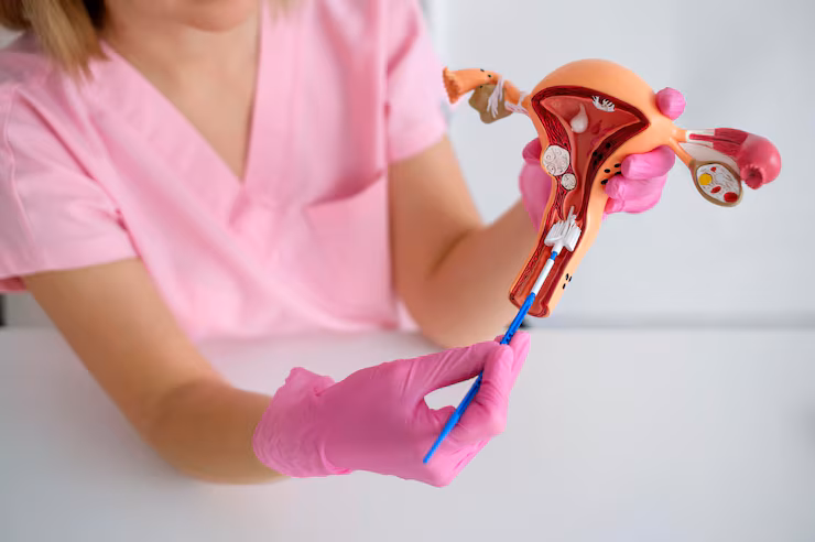Intra-Uterine Insemination (IUI)