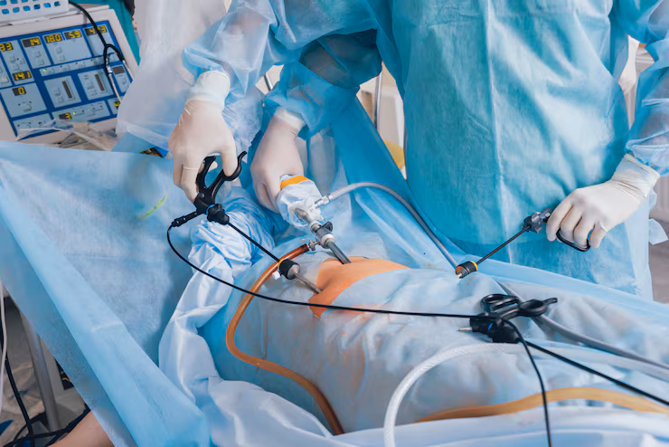 Open and Laparoscopy