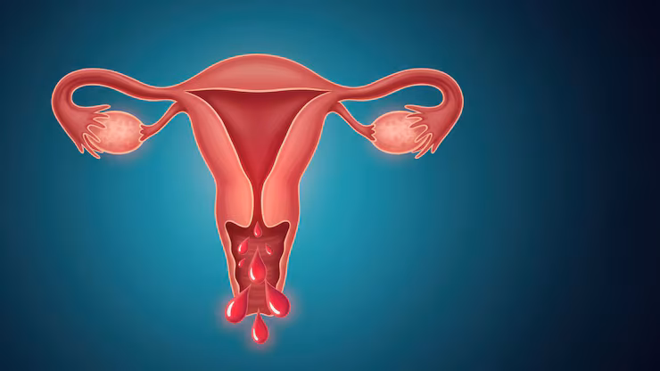 Abnormal Uterus Bleeding Treatment